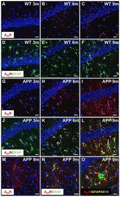 Beneficial Effect of a Selective Adenosine A2A Receptor Antagonist in the APPswe/PS1dE9 Mouse Model of Alzheimer’s Disease